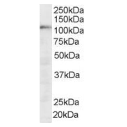 Western Blot - Anti-SART1 Antibody (A83261) - Antibodies.com