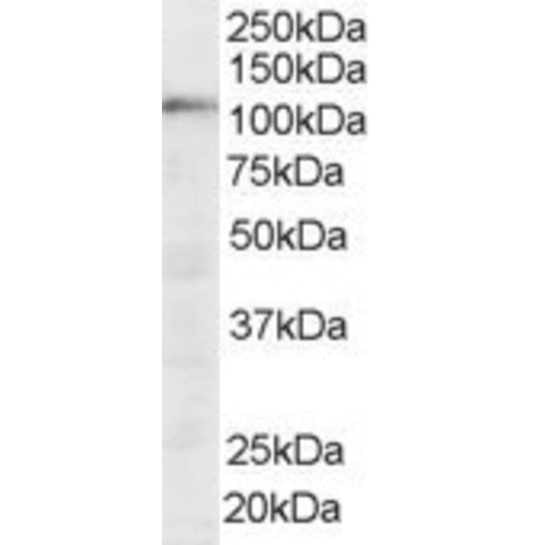 Western Blot - Anti-SART1 Antibody (A83261) - Antibodies.com