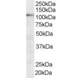Western Blot - Anti-SART1 Antibody (A83261) - Antibodies.com
