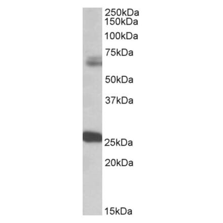 Western Blot - Anti-GAD2 Antibody (A83263) - Antibodies.com