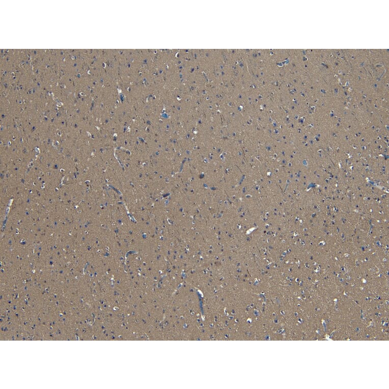 Immunohistochemistry - Anti-GAD65 Antibody (A83263) - Antibodies.com