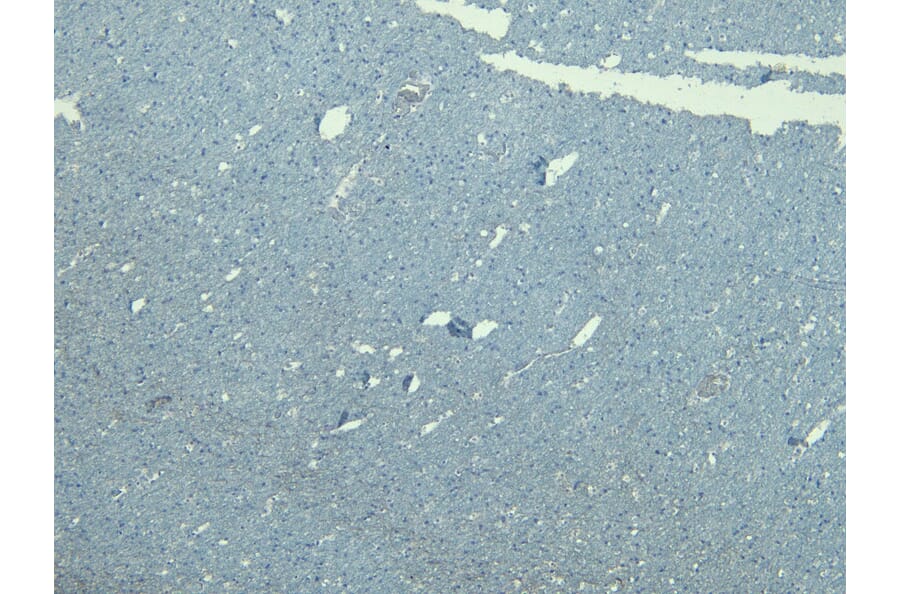 Immunohistochemistry - Anti-GAD65 Antibody (A83263) - Antibodies.com