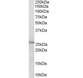 Western Blot - Anti-GSTM1 Antibody (A83264) - Antibodies.com