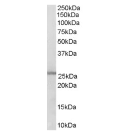 Western Blot - Anti-GSTM1 Antibody (A83264) - Antibodies.com