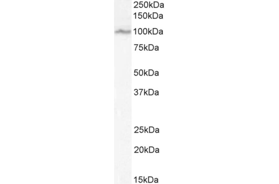 Western Blot - Anti-OSBPL5/ORP5 Antibody (A83267) - Antibodies.com