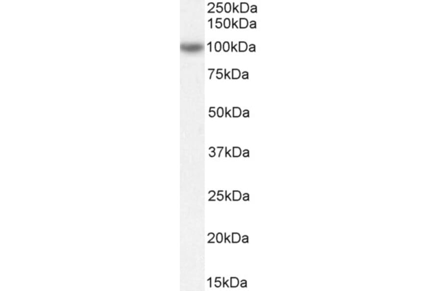 Western Blot - Anti-OSBPL5/ORP5 Antibody (A83267) - Antibodies.com
