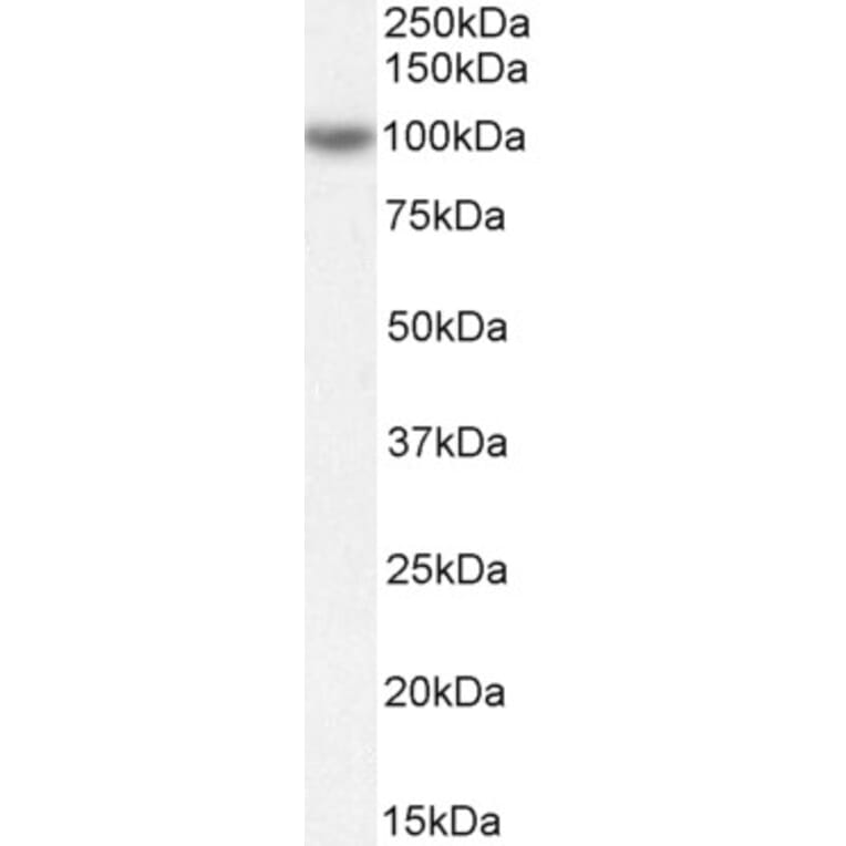 Western Blot - Anti-OSBPL5/ORP5 Antibody (A83267) - Antibodies.com