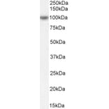 Western Blot - Anti-OSBPL5/ORP5 Antibody (A83267) - Antibodies.com