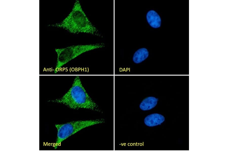Immunofluorescence - Anti-OSBPL5/ORP5 Antibody (A83267) - Antibodies.com