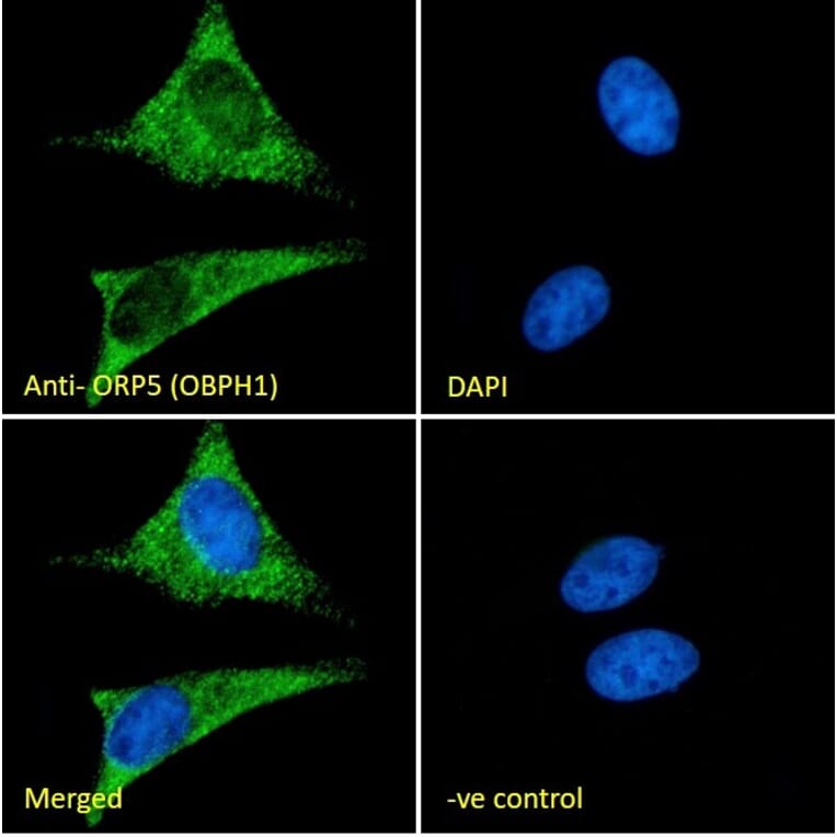 Immunofluorescence - Anti-OSBPL5/ORP5 Antibody (A83267) - Antibodies.com