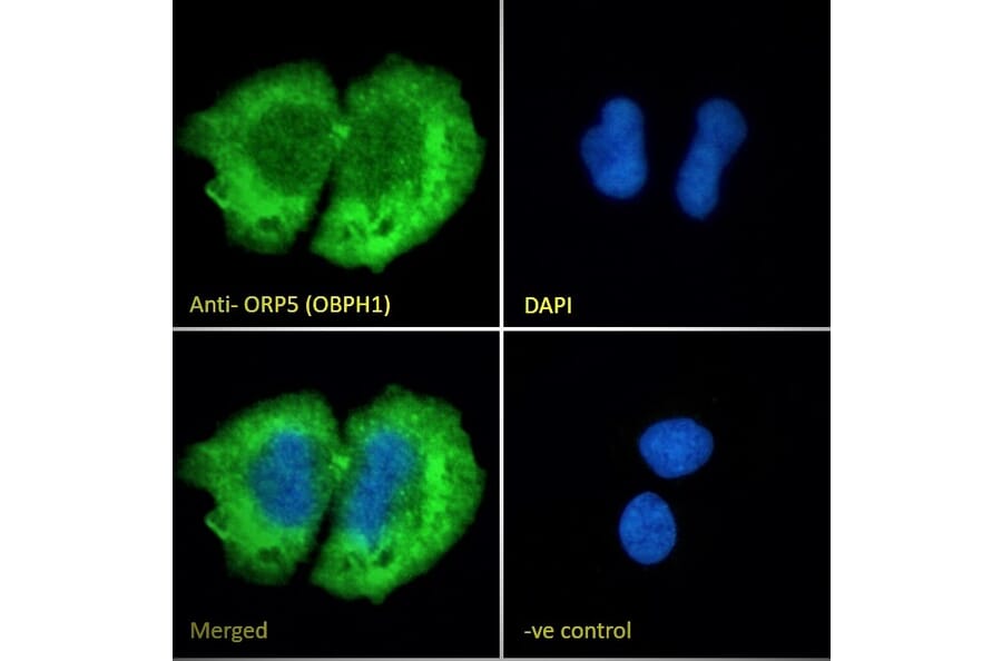 Immunofluorescence - Anti-OSBPL5/ORP5 Antibody (A83267) - Antibodies.com