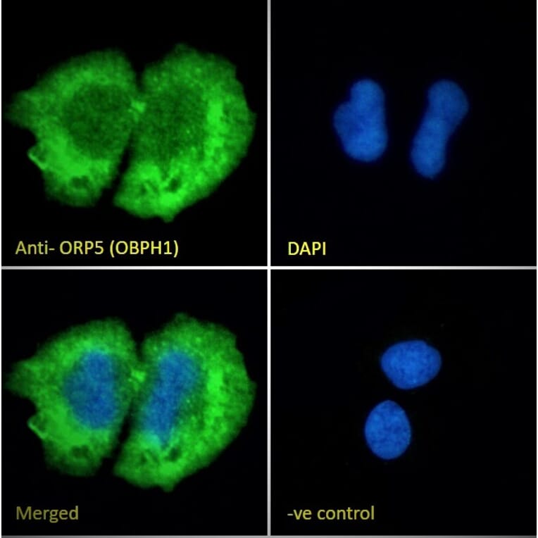 Immunofluorescence - Anti-OSBPL5/ORP5 Antibody (A83267) - Antibodies.com