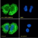 Immunofluorescence - Anti-OSBPL5/ORP5 Antibody (A83267) - Antibodies.com