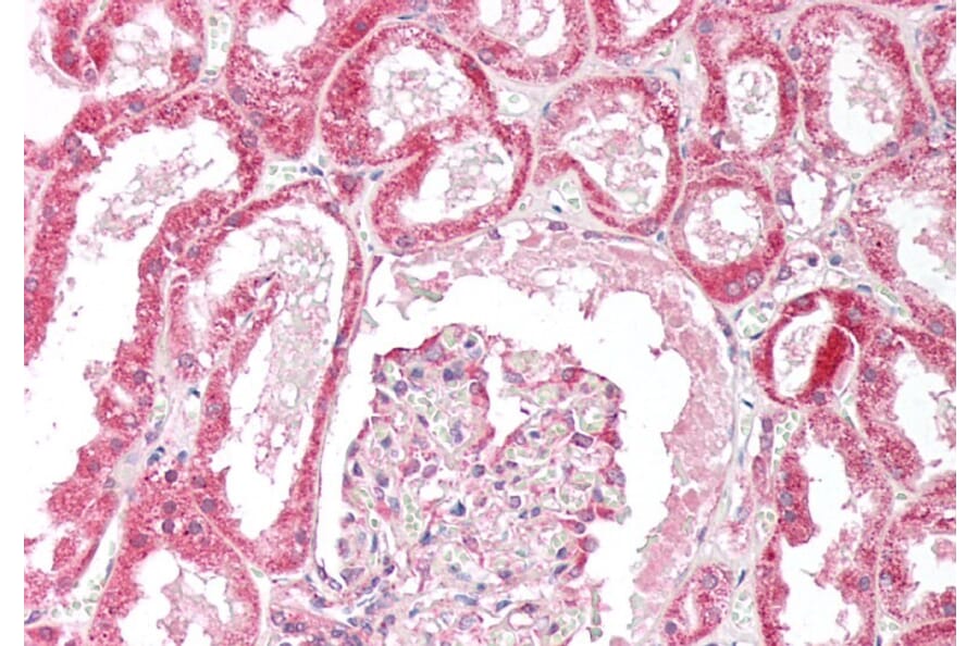 Immunohistochemistry - Anti-OSBPL5/ORP5 Antibody (A83267) - Antibodies.com
