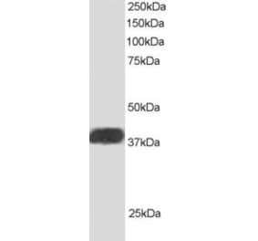 Western Blot - Anti-ALS2CR1 Antibody (A83268) - Antibodies.com