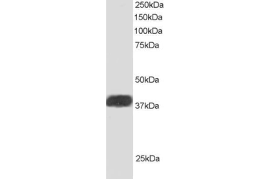 Western Blot - Anti-ALS2CR1 Antibody (A83268) - Antibodies.com