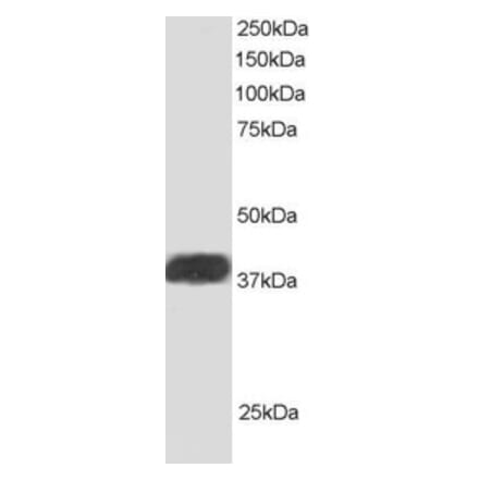 Western Blot - Anti-ALS2CR1 Antibody (A83268) - Antibodies.com