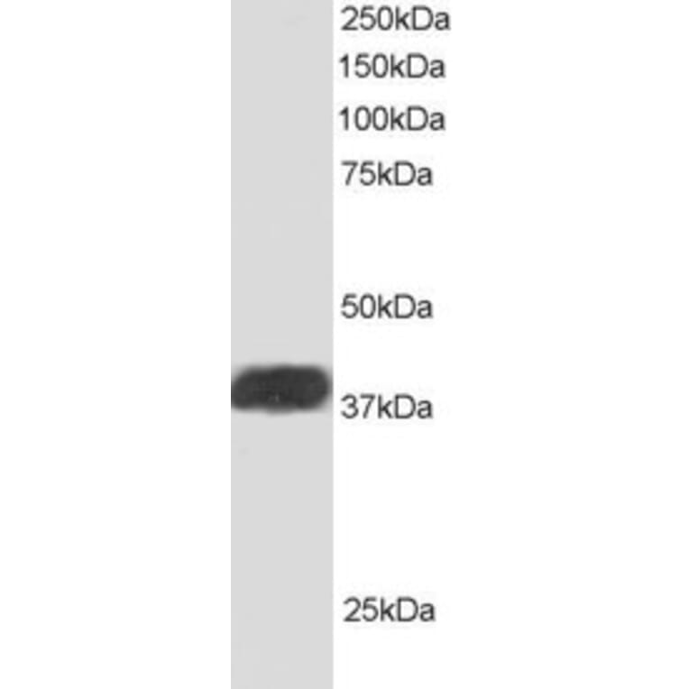 Western Blot - Anti-ALS2CR1 Antibody (A83268) - Antibodies.com
