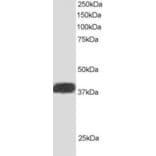Western Blot - Anti-ALS2CR1 Antibody (A83268) - Antibodies.com
