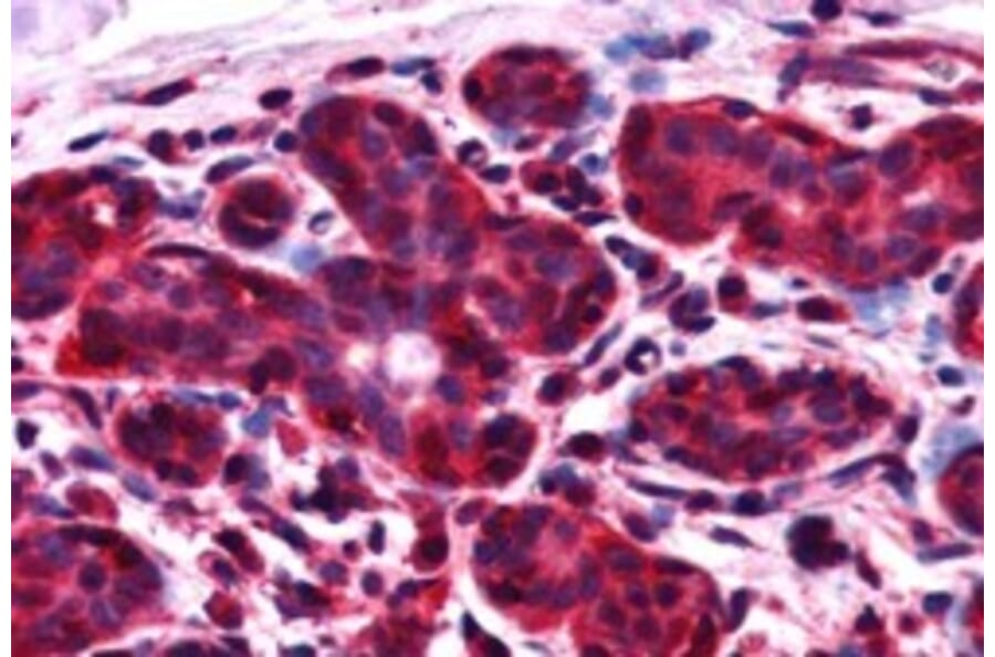 Immunohistochemistry - Anti-ALS2CR1 Antibody (A83268) - Antibodies.com