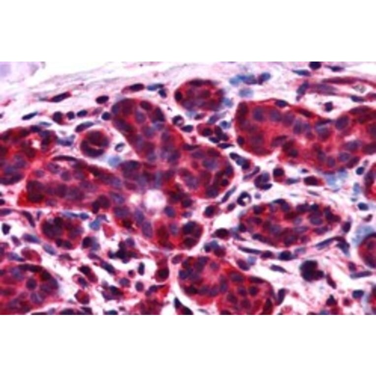 Immunohistochemistry - Anti-ALS2CR1 Antibody (A83268) - Antibodies.com