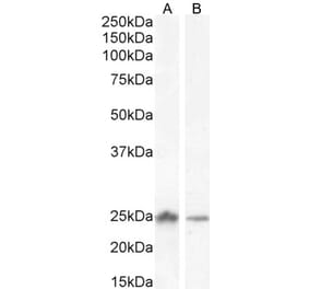 Western Blot - Anti-COMT Antibody (A83269) - Antibodies.com