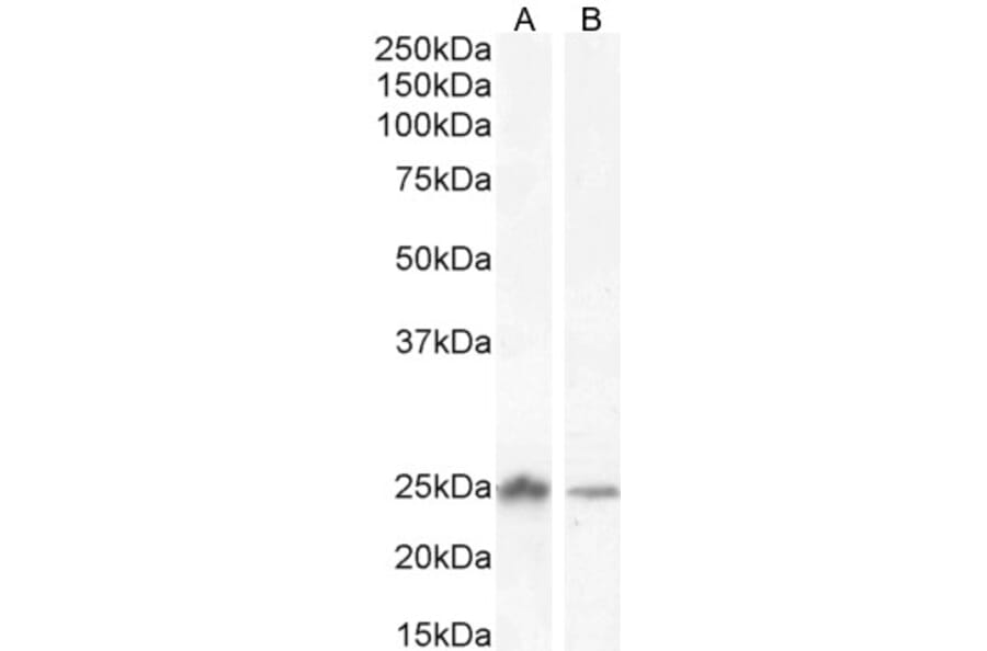 Western Blot - Anti-COMT Antibody (A83269) - Antibodies.com