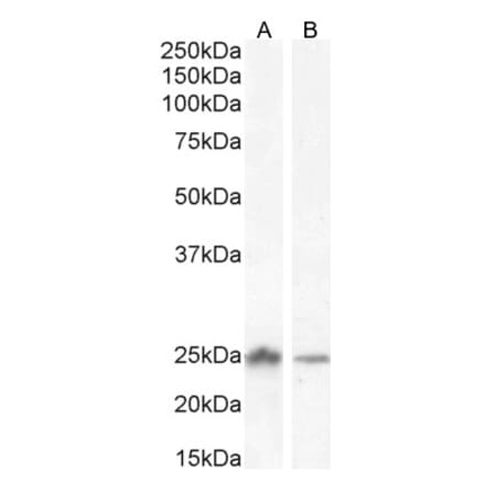 Western Blot - Anti-COMT Antibody (A83269) - Antibodies.com