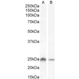 Western Blot - Anti-COMT Antibody (A83269) - Antibodies.com