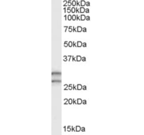 Western Blot - Anti-COMT Antibody (A83269) - Antibodies.com