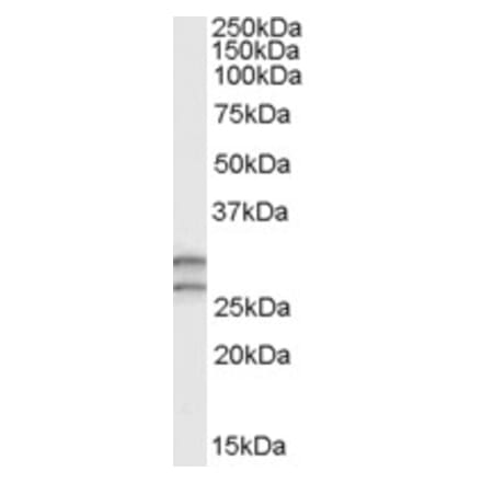 Western Blot - Anti-COMT Antibody (A83269) - Antibodies.com