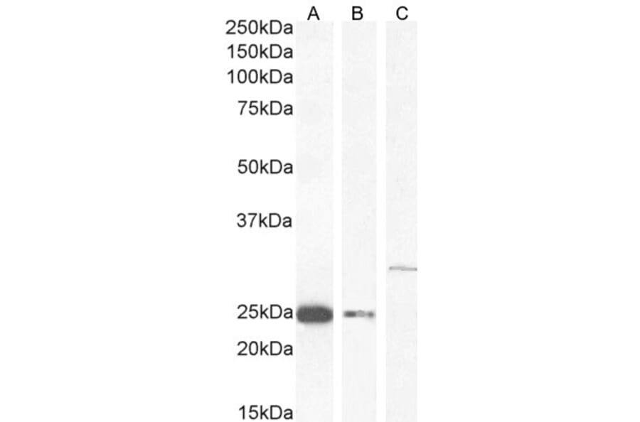 Western Blot - Anti-COMT Antibody (A83269) - Antibodies.com