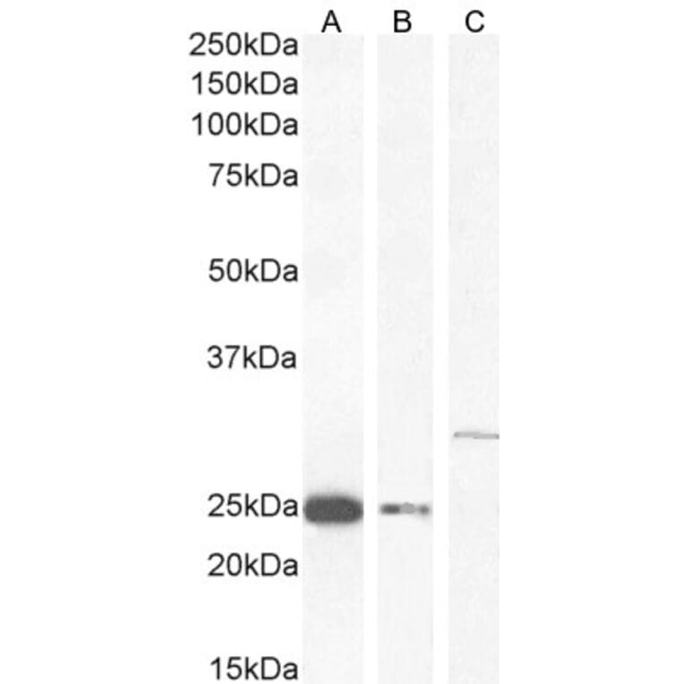 Western Blot - Anti-COMT Antibody (A83269) - Antibodies.com