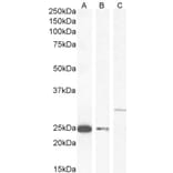 Western Blot - Anti-COMT Antibody (A83269) - Antibodies.com