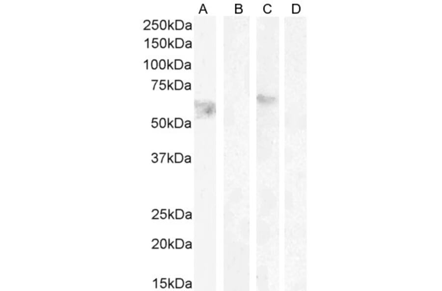 Western Blot - Anti-Cannabinoid Receptor I Antibody (A83270) - Antibodies.com