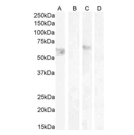 Western Blot - Anti-Cannabinoid Receptor I Antibody (A83270) - Antibodies.com