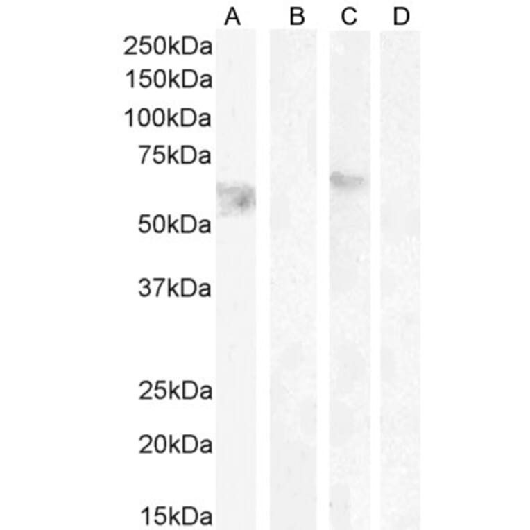 Western Blot - Anti-Cannabinoid Receptor I Antibody (A83270) - Antibodies.com