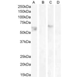 Western Blot - Anti-Cannabinoid Receptor I Antibody (A83270) - Antibodies.com