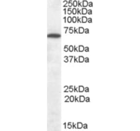 Western Blot - Anti-CNR1 Antibody (A83270) - Antibodies.com
