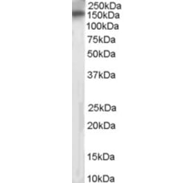 Western Blot - Anti-PTPRT Antibody (A83271) - Antibodies.com