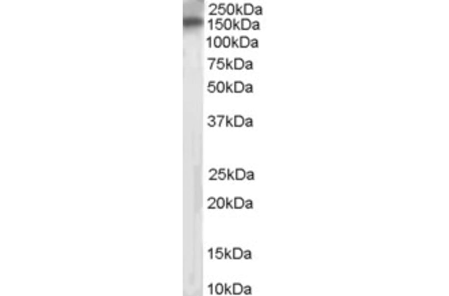 Western Blot - Anti-PTPRT Antibody (A83271) - Antibodies.com