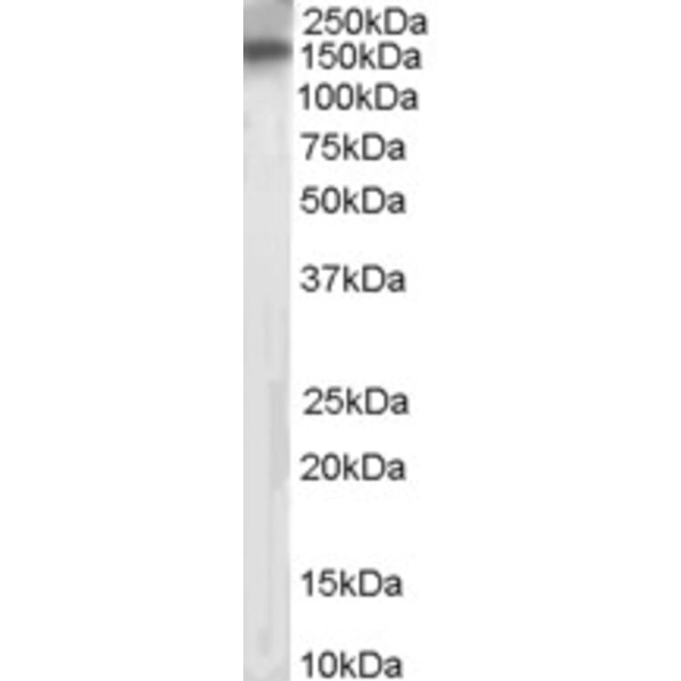 Western Blot - Anti-PTPRT Antibody (A83271) - Antibodies.com