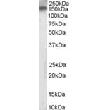 Western Blot - Anti-PTPRT Antibody (A83271) - Antibodies.com