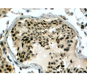 Immunohistochemistry - Anti-RAD51AP1 Antibody (A83275) - Antibodies.com