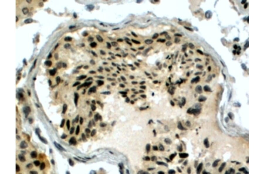 Immunohistochemistry - Anti-RAD51AP1 Antibody (A83275) - Antibodies.com
