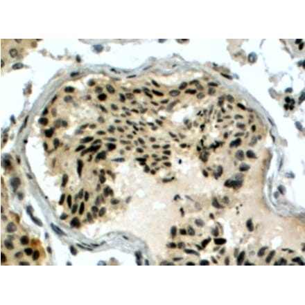 Immunohistochemistry - Anti-RAD51AP1 Antibody (A83275) - Antibodies.com