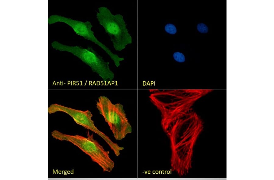 Immunofluorescence - Anti-RAD51AP1 Antibody (A83275) - Antibodies.com