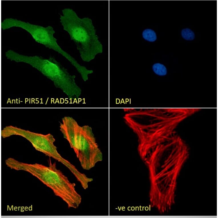 Immunofluorescence - Anti-RAD51AP1 Antibody (A83275) - Antibodies.com