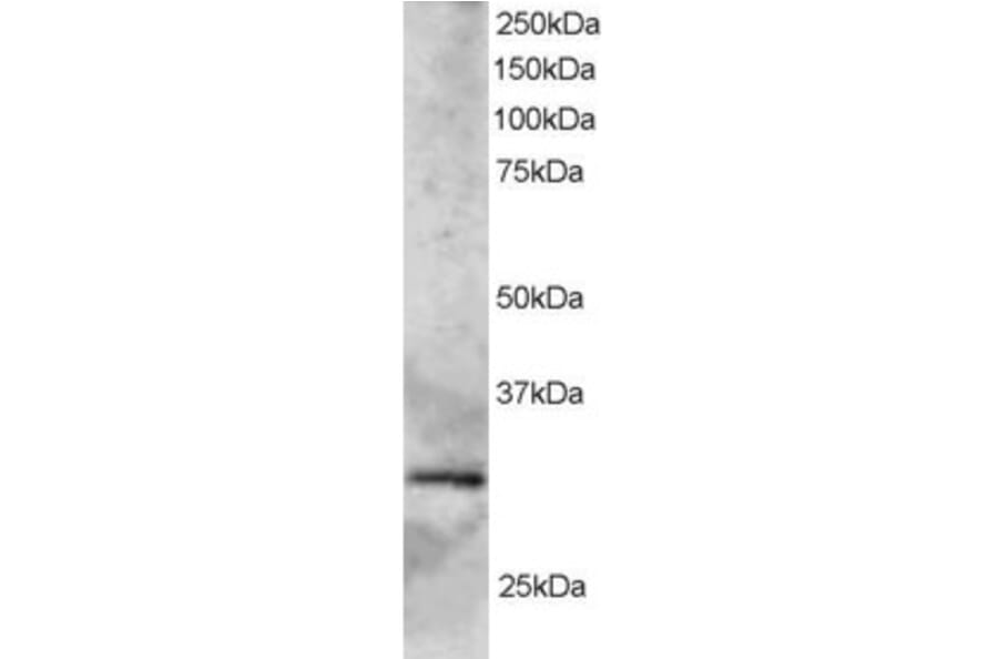 Western Blot - Anti-GCIP Interacting Protein p29 Antibody (A83276) - Antibodies.com