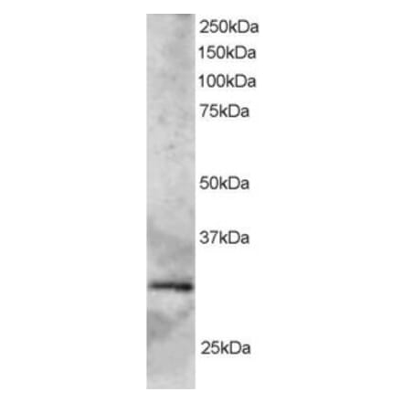 Western Blot - Anti-GCIP Interacting Protein p29 Antibody (A83276) - Antibodies.com